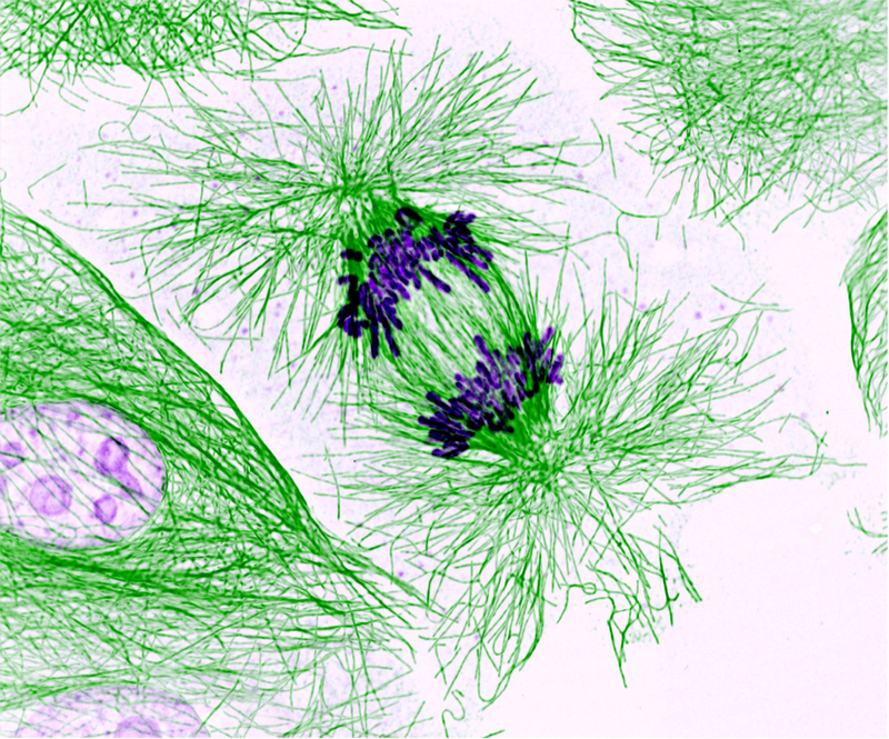 Illustration for article titled The Astounding And Horrific World As Seen Under A Microscope